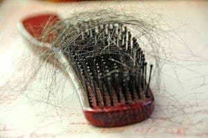 going bald