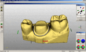 cerec technology