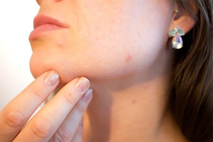 Eerie Skin Conditions Caused By Subpar Cosmetics