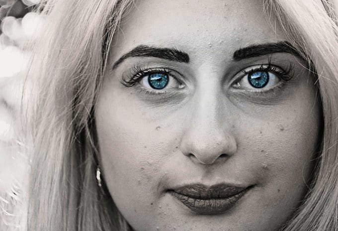 How can acne affect you emotionally?