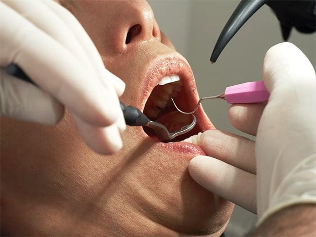 Dental Health
