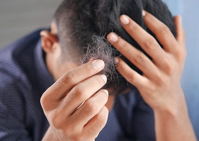 Top 5 Hair loss treatment methods