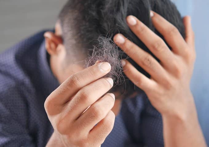 Men’s Hair Loss: Everything You Need to Know About Possible Treatments