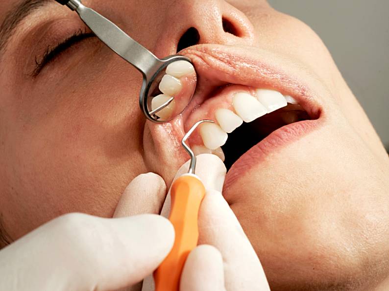 How to Achieve the Perfect Smile: A Guide