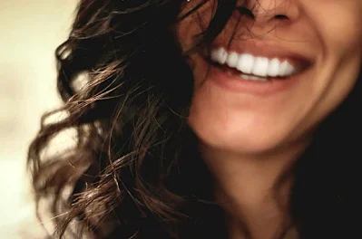 What to Expect Before and After Getting Dental Veneers