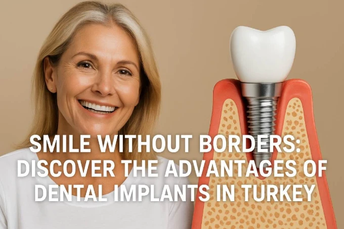 Getting Dental Veneers