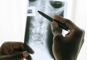 spinal surgery x ray