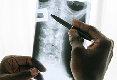 Active individuals turn to motion-preserving spinal surgery to protect everyday agility